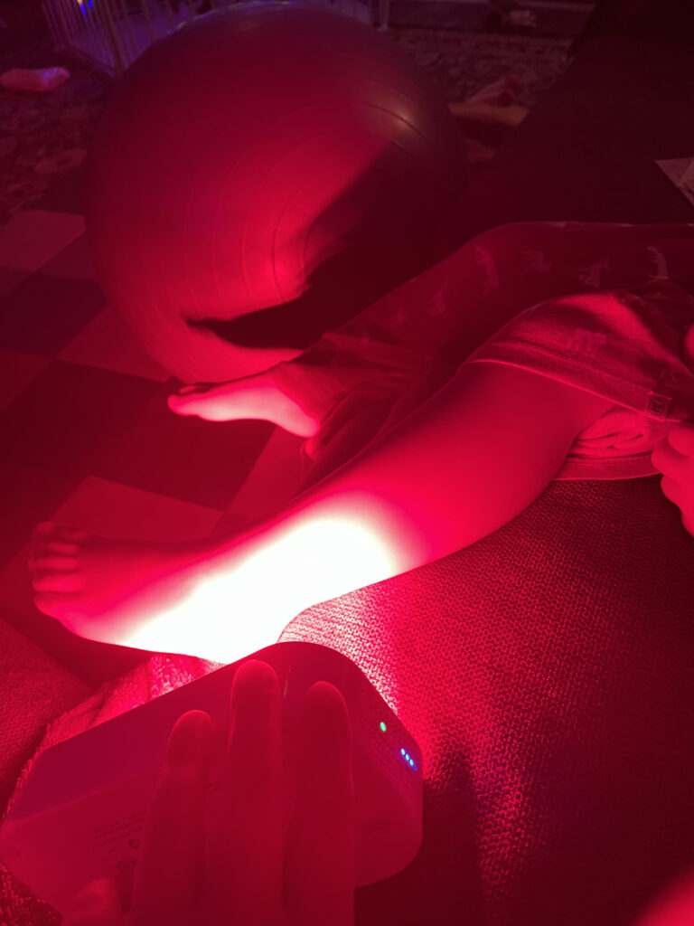 Using red light on Childs leg that is hurt